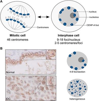 CENP-A Regulation and Cancer